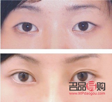 雙眼皮類型(雙眼皮類型哪個最好看)