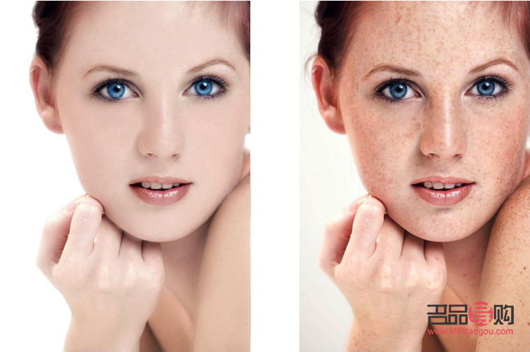 激光美容維持多久(激光美容維持多久可以洗臉)