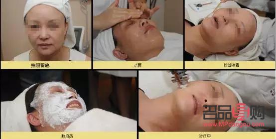 微針美容怎么做(微針美容步驟)