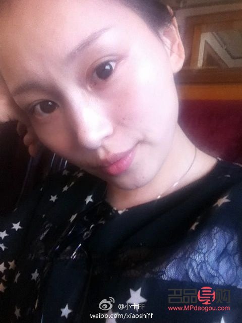 弄雙眼皮會(huì)有后遺癥嗎(弄雙眼皮會(huì)有后遺癥嗎知乎)