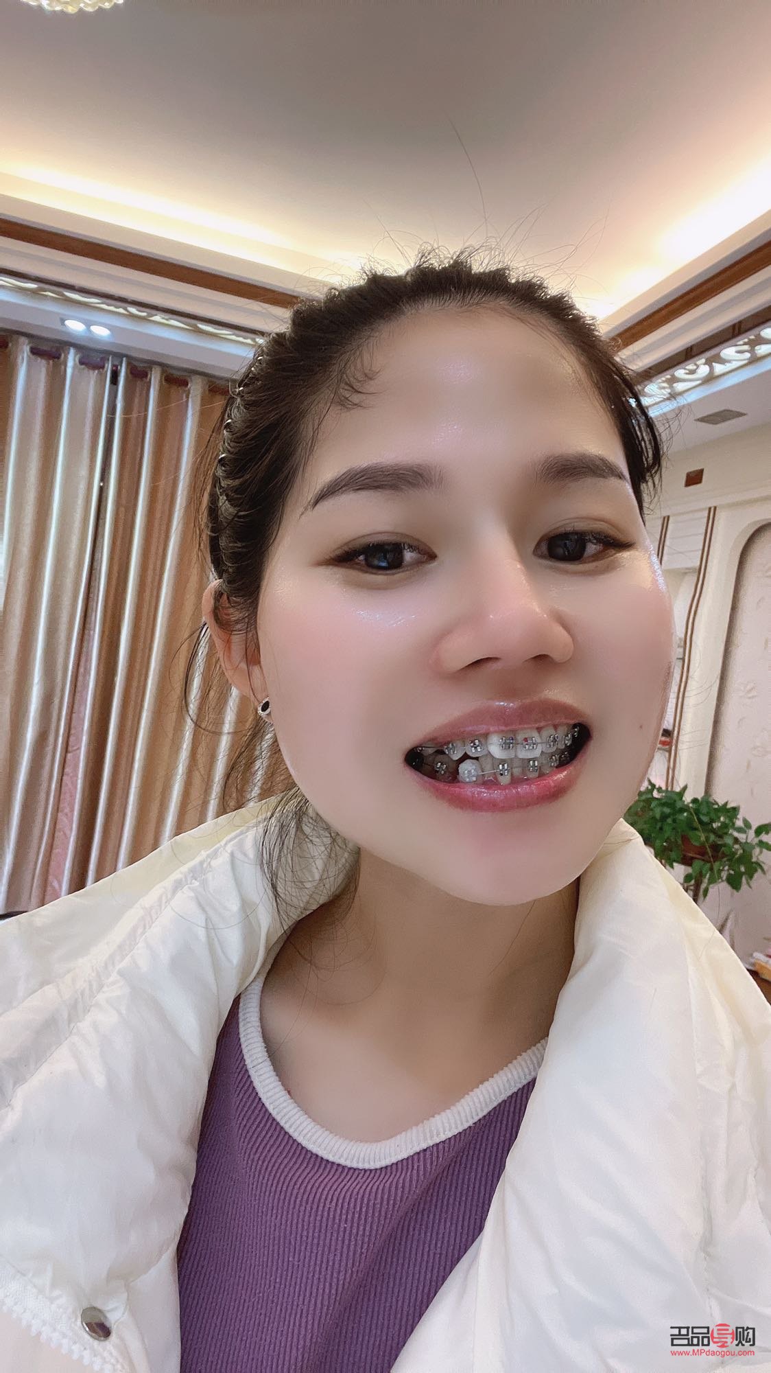 鋼牙妹怎么護理身體(鋼牙妹怎么護理身體健康)