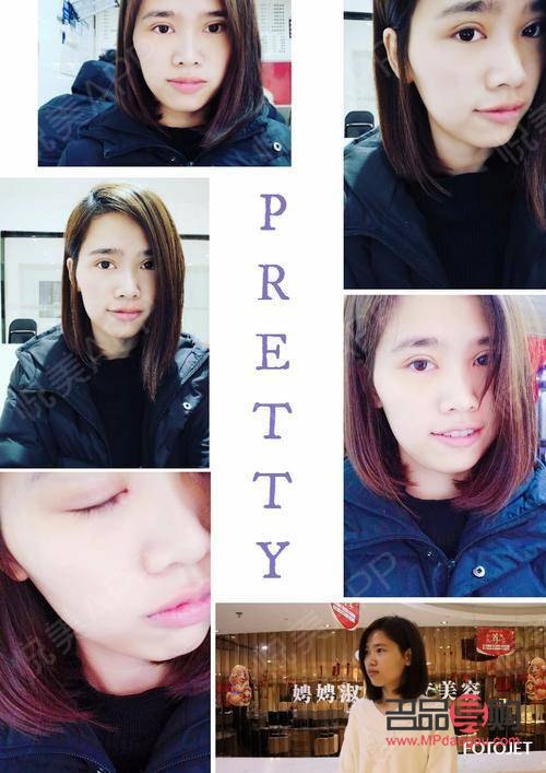 割雙眼皮后多久恢復(fù)自然(割雙眼皮后多久恢復(fù)自然一點)