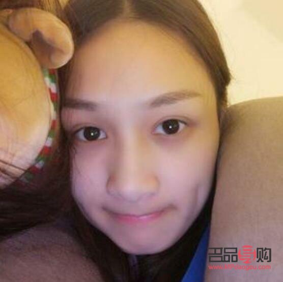 割雙眼皮后多久恢復(fù)自然(割雙眼皮后多久恢復(fù)自然一點)