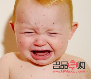 過敏身體怎么護理好(過敏身體怎么護理好呢)