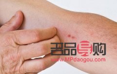 過敏身體怎么護理好(過敏身體怎么護理好呢)