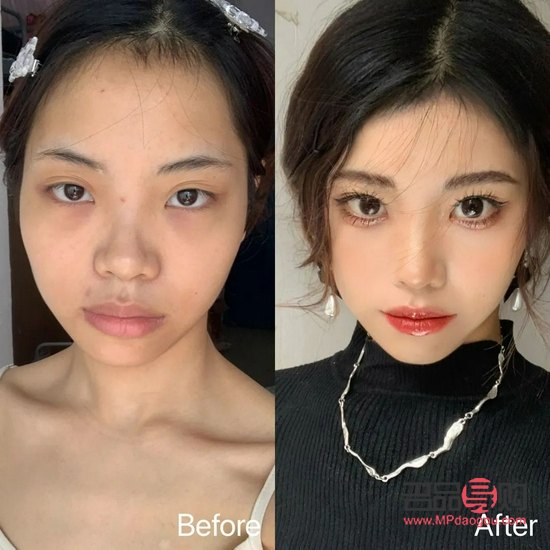 <h3>美容切眉：真的能讓我們更年輕嗎？</h3>