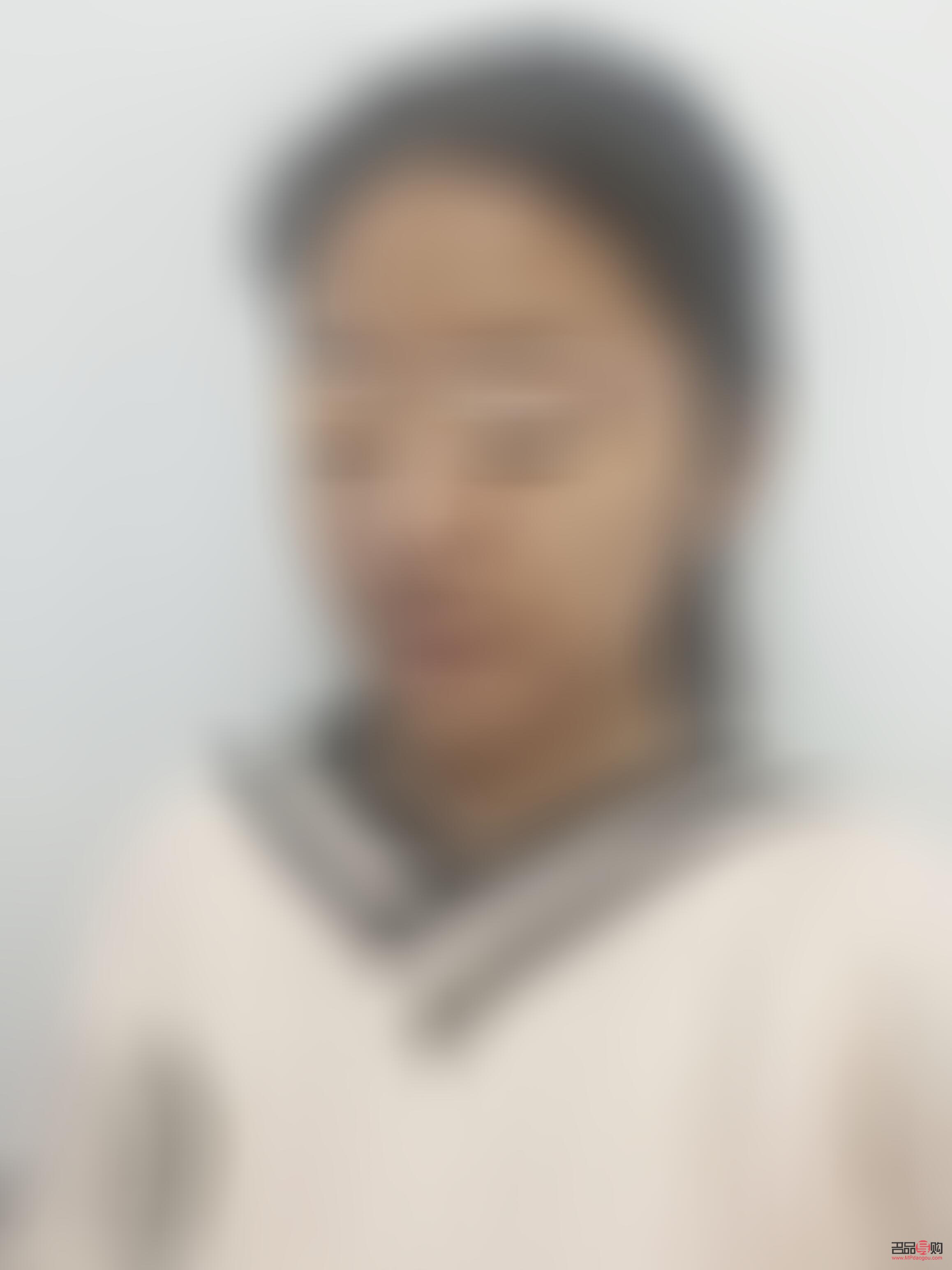 <h3>眼綜合20天依然腫脹，如何應對？</h3>