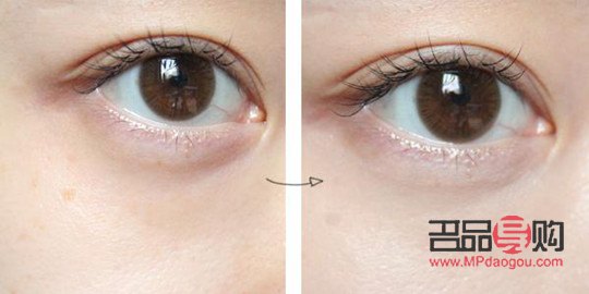 學(xué)生黨怎樣去眼袋(學(xué)生去眼袋小妙招)