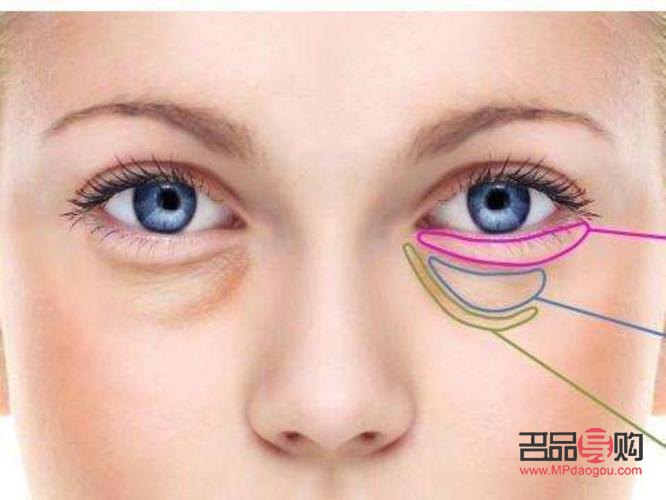 提拉眼角是不是辱華(提拉眼角多少錢)