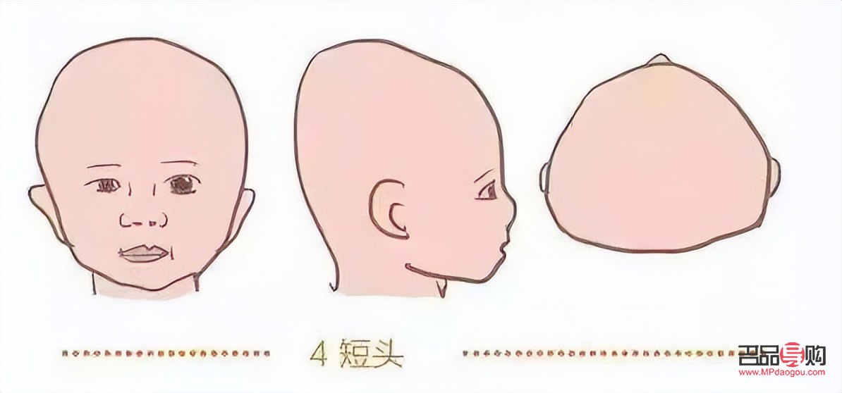 怎樣改善大小眼(怎樣改善大小眼問題)
