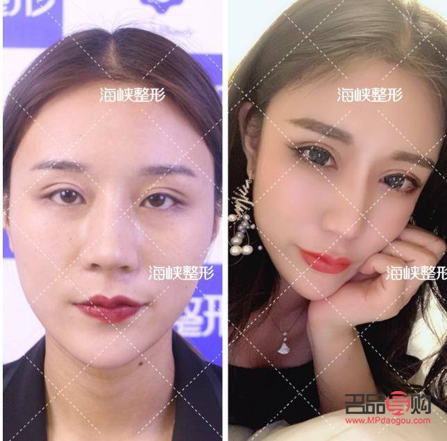 <h3>雙眼皮與翹睫：美化眼部輪廓的必要步驟？</h3>