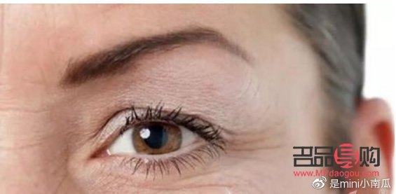 眼皮下垂是提眉好還是割雙眼皮好(眼皮下垂是提眉好還是割雙眼皮好呢)