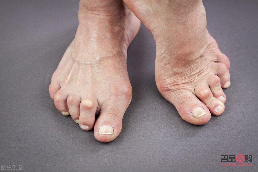 <h3>雨天是否適宜做身體護(hù)理？</h3>