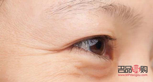 眼睛下邊長(zhǎng)皺紋是怎么回事(眼睛下邊長(zhǎng)皺紋是怎么回事兒)