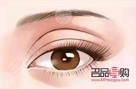 眼角下垂手術(shù)大概得多少錢(做雙眼皮手術(shù)要多久才能恢復(fù)好)