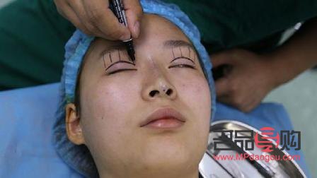 雙眼皮手術(shù)后的“顯老”之憂