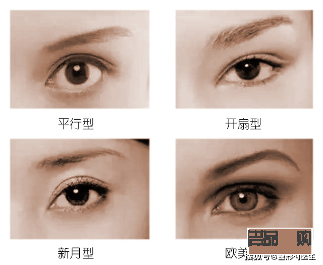 <h3>割雙眼皮30天恢復圖真實記錄</h3>