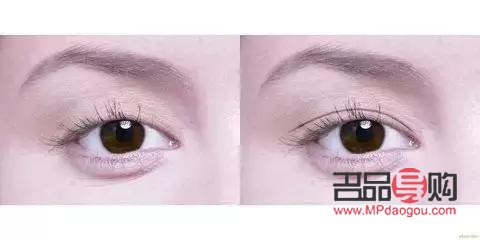 四十歲雙眼皮下垂了怎么辦(四十多歲變雙眼皮了)