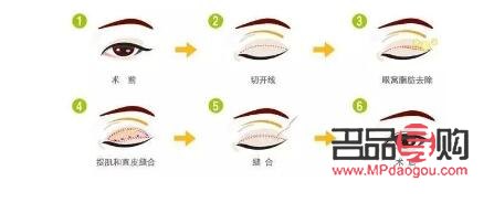 <h3>消除腫眼泡的有效方法</h3>