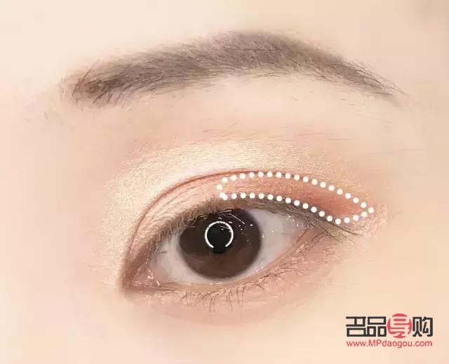 天生上眼皮腫怎么消除(天生上眼皮腫怎么消除常見方法)