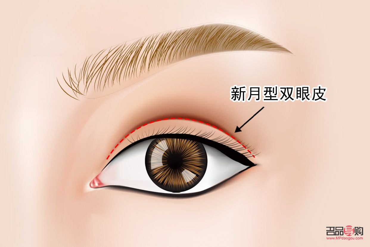 新月型雙眼皮為什么會(huì)顯老(新月型雙眼皮為什么會(huì)顯老一點(diǎn))