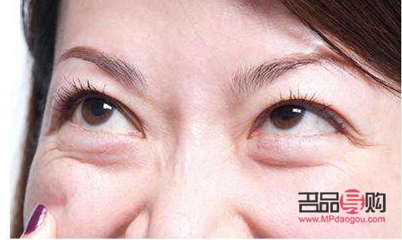 輕微眼袋怎么去除最快(輕微眼袋怎么去除最快方法)
