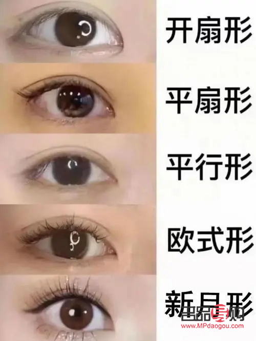 <h3>平扇型雙眼皮恢復(fù)圖詳解</h3>