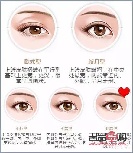 上眼皮突然有褶皺圖片(上眼皮多層褶皺怎么辦)