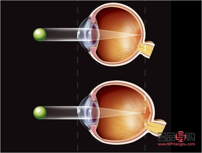 怎么才能保養(yǎng)眼睛(怎么才能保養(yǎng)眼睛不近視)