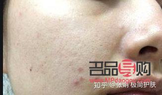 身體乳與手部護(hù)理：一種多功能的護(hù)膚選擇