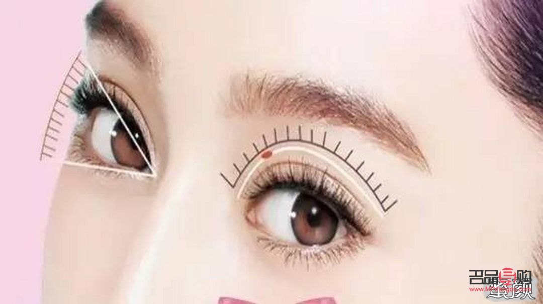 雙眼皮三點(diǎn)定位是什么意思(雙眼皮三點(diǎn)定位好嗎)