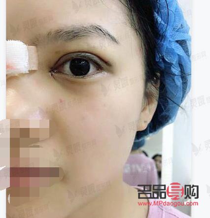 宜昌雙眼皮整形，哪家醫(yī)院更出眾？