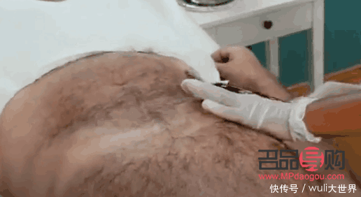 怎么脫毛美容(怎么脫毛美容效果好)