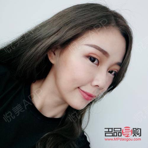 雙眼皮手術(shù)：如何選擇最佳方案？