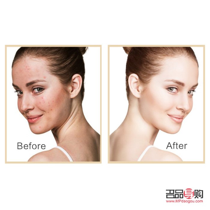 美容不足的壞處及影響