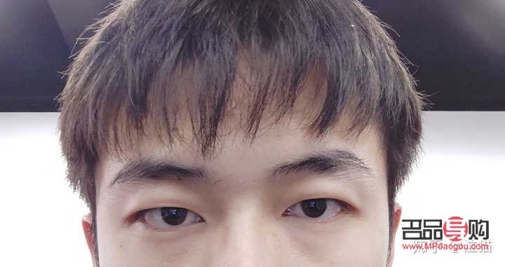 <h3>眼睛高低不對(duì)稱怎么辦？專業(yè)解答與實(shí)用建議</h3>