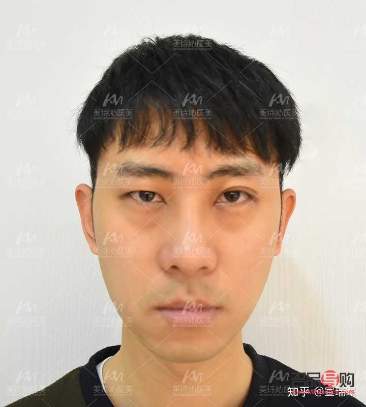 <h3>眼睛高低不對(duì)稱怎么辦？專業(yè)解答與實(shí)用建議</h3>