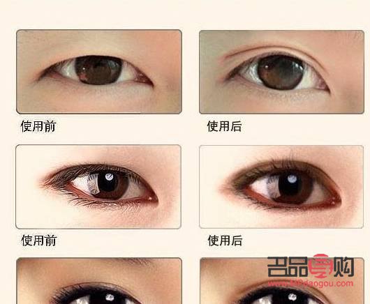 雙眼皮的魅力：哪些人更適合擁有雙眼皮？