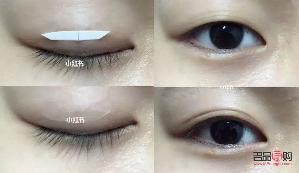 哪種雙眼皮貼最舒服又好用(哪種雙眼皮貼最舒服又好用的)