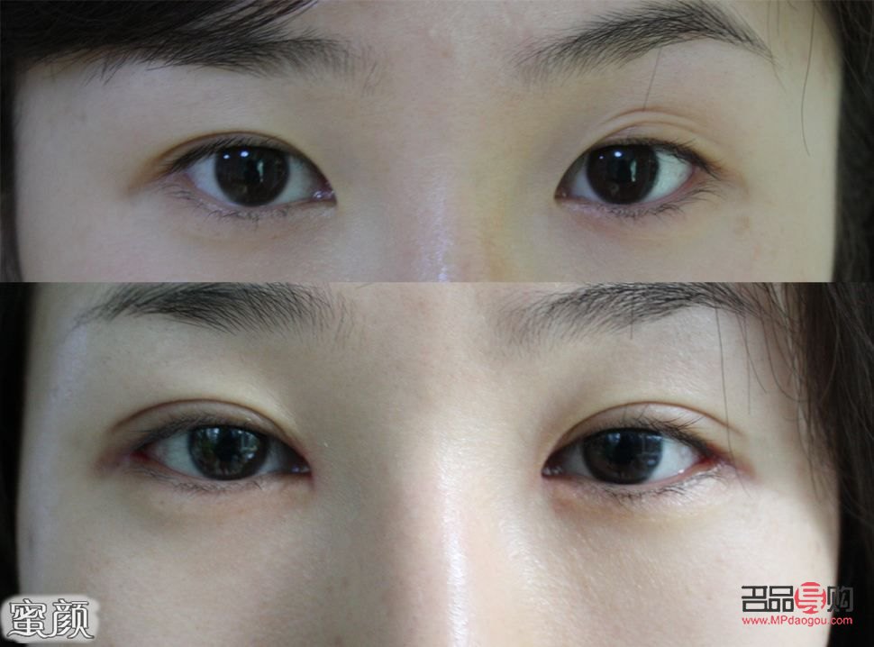 做哪種雙眼皮最自然呢(做哪種雙眼皮最自然呢女生)