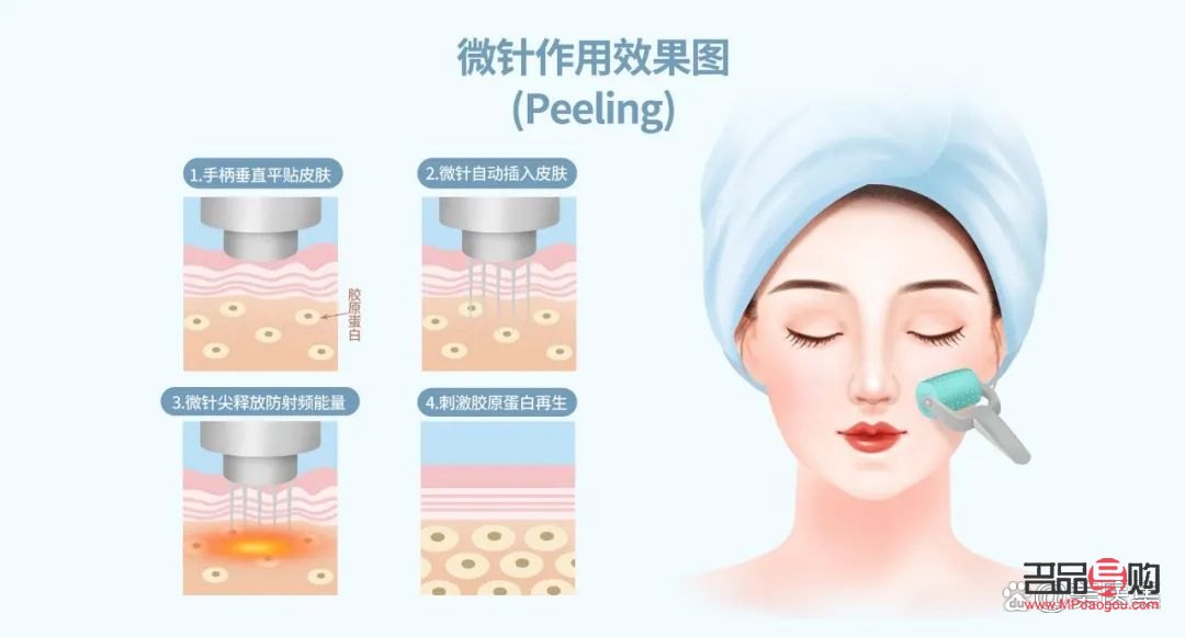 <h3>微針美容：肌膚煥新的秘密武器</h3>