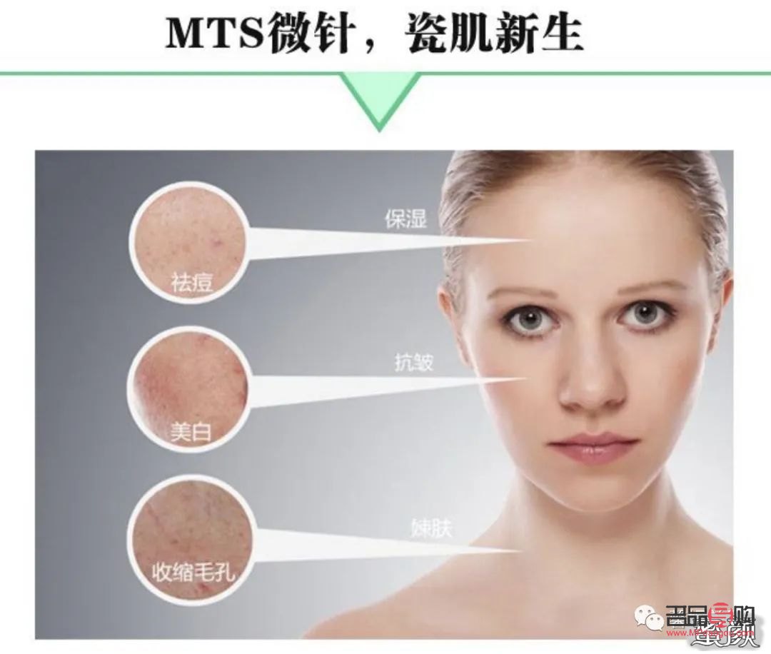 微針美容：肌膚煥新的秘密武器