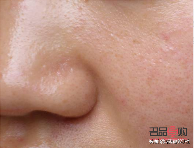 身體皮膚油性怎么護(hù)理(身體皮膚油性怎么護(hù)理最好)