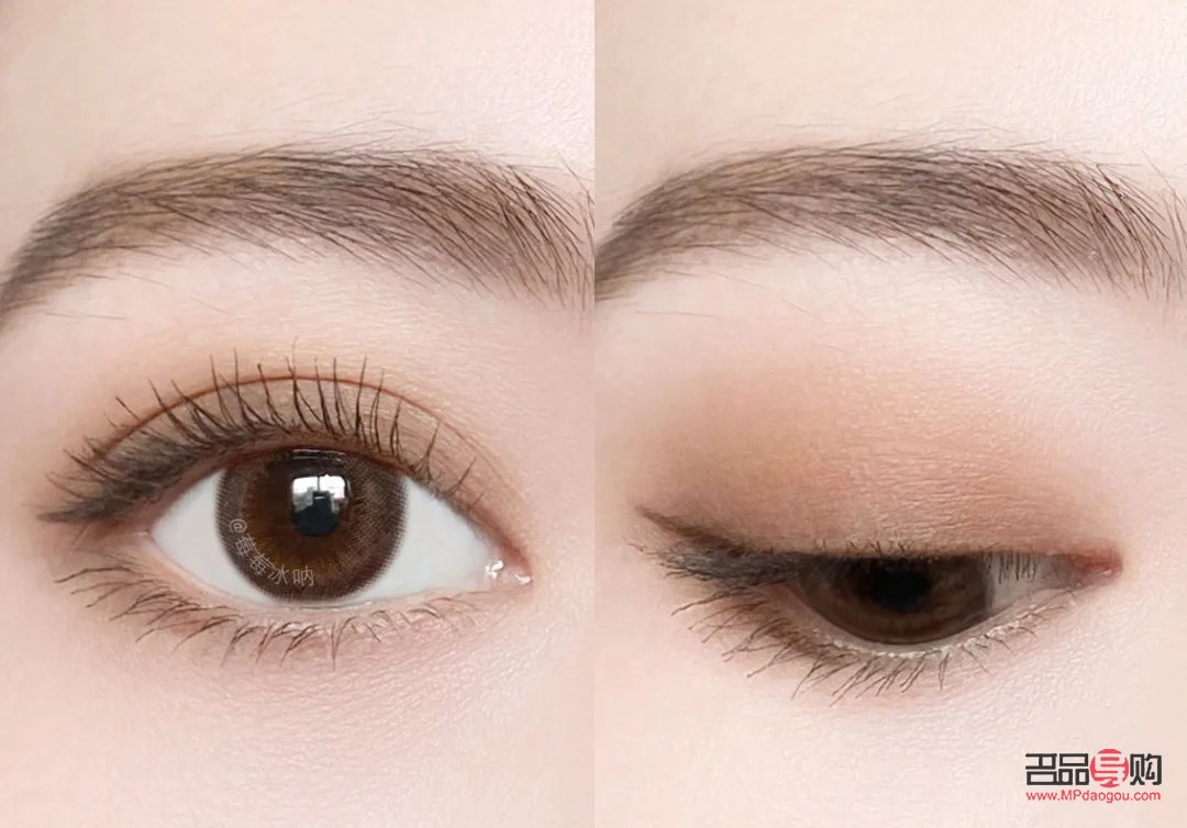 腫眼泡除了手術還有什么辦法(腫眼泡除了手術還有什么辦法消腫)