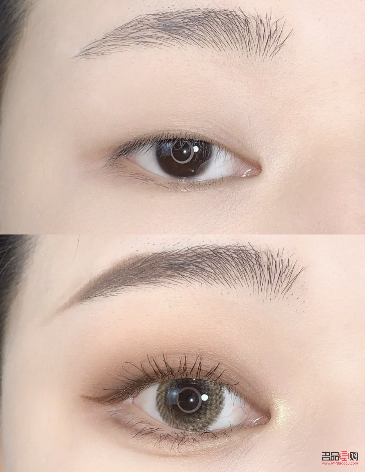 腫眼泡除了手術還有什么辦法(腫眼泡除了手術還有什么辦法消腫)