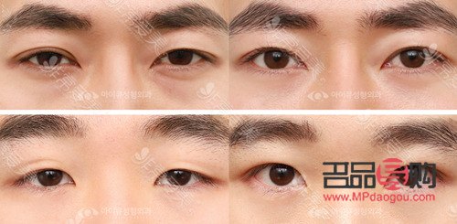 雙眼皮眼型圖片男(雙眼皮眼型圖片男人)