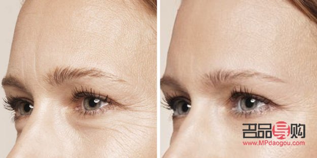 <h3>眼部抗衰效果深度解析</h3>