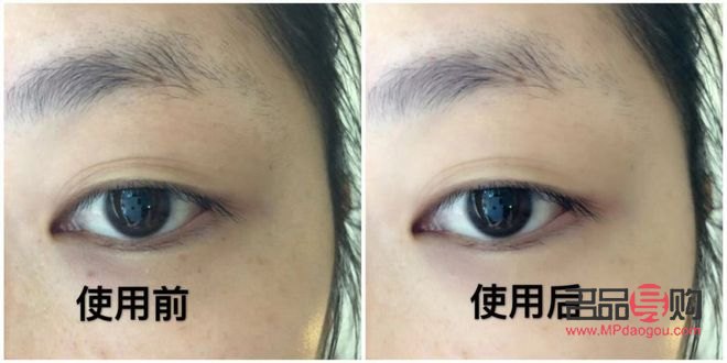 黑眼圈與眼袋的終結(jié)者：快速消除秘籍大公開