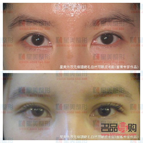 美容醫(yī)保報(bào)銷嗎(整形美容科醫(yī)保報(bào)銷嗎)