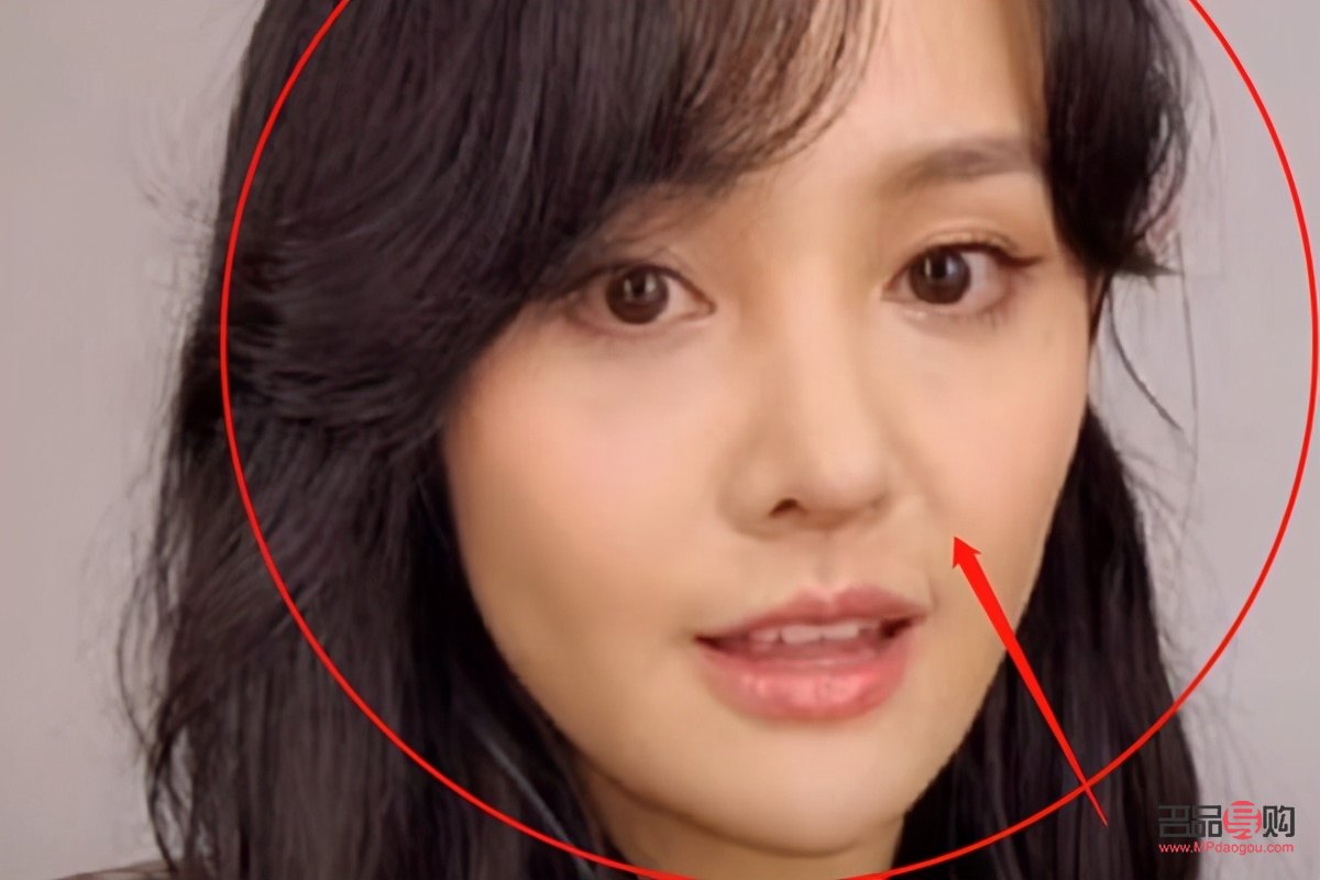 填充眼窩凹陷手術(shù)多少錢啊圖片(填充眼窩凹陷手術(shù)多少錢啊圖片視頻)